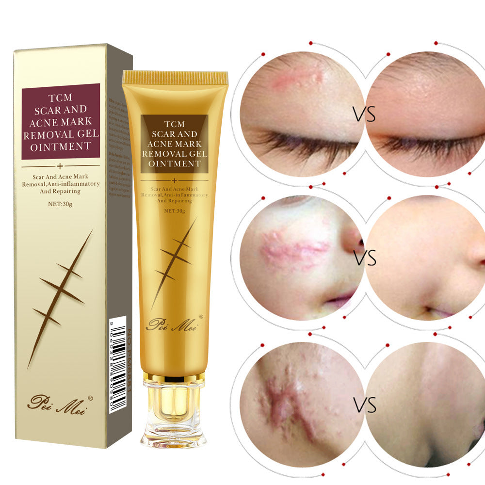 Light Scar Cream, Fine-Grained Scar Fading Skin Care Products