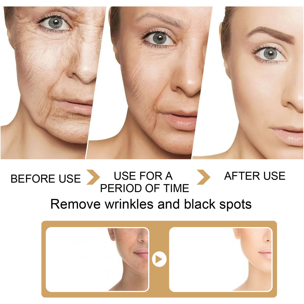 EELHOE Turmeric Dark Spot Correction Face Care Moisturizing and Repairing Skin Tone Serum