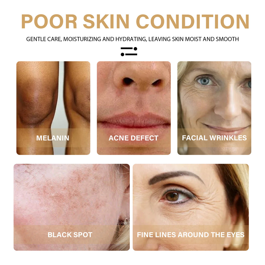 EELHOE Turmeric Dark Spot Correction Face Care Moisturizing and Repairing Skin Tone Serum